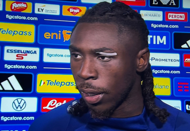 莫伊塞-基恩谈欧国联失利：期待卡拉菲奥里复出，次回合全力争胜